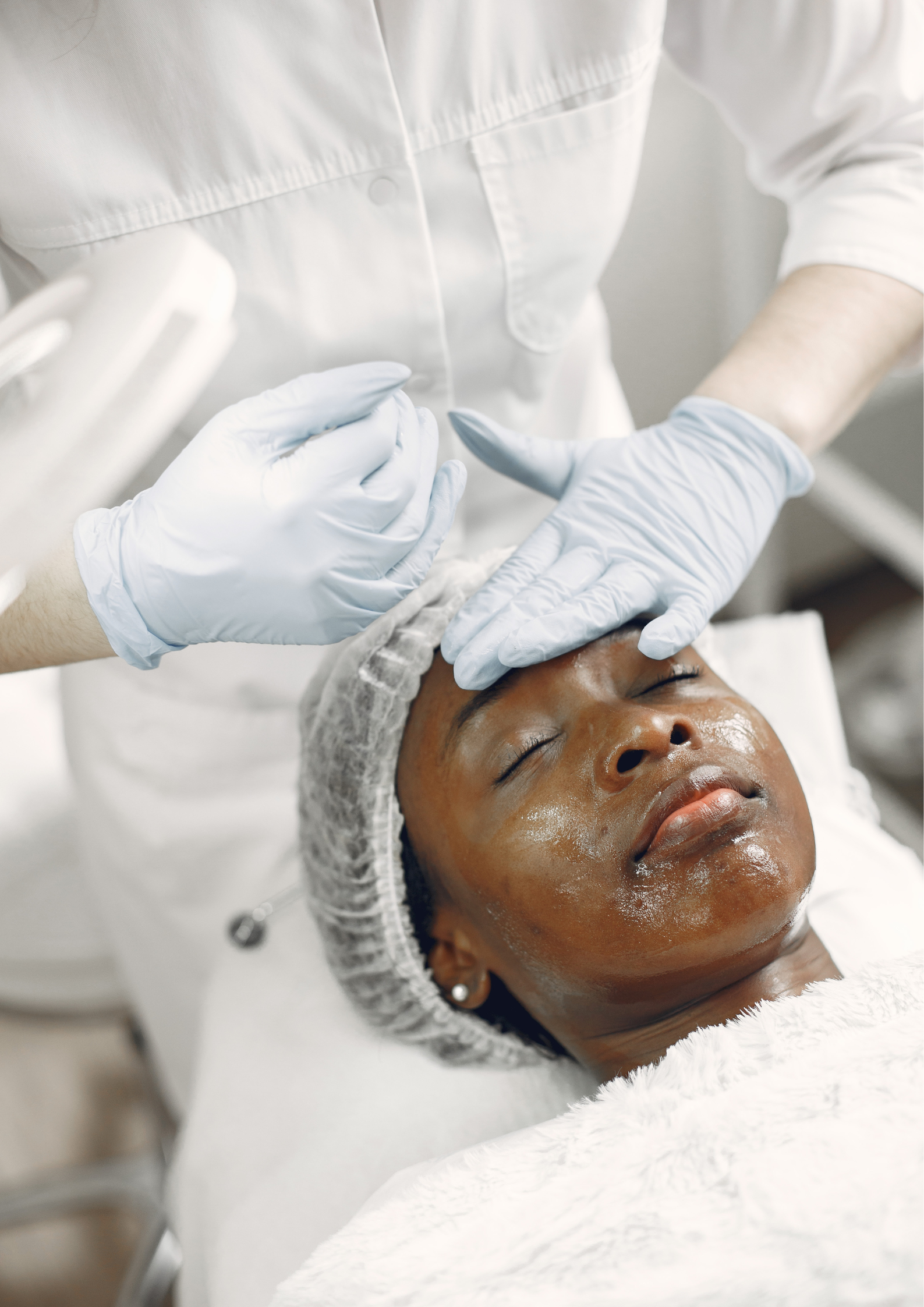 Chemical Peel Treatment