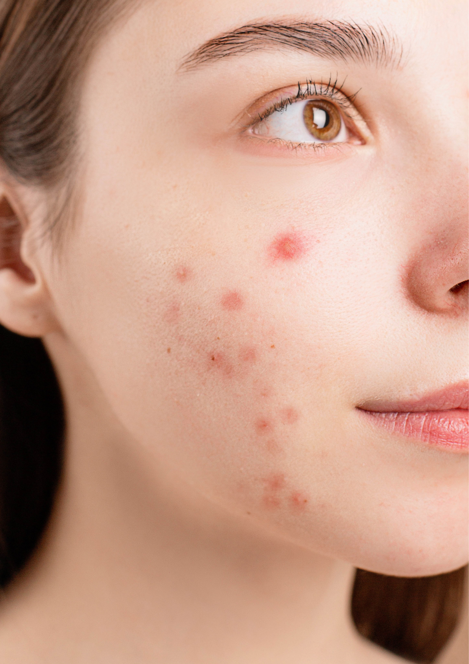 Medical Dermatology